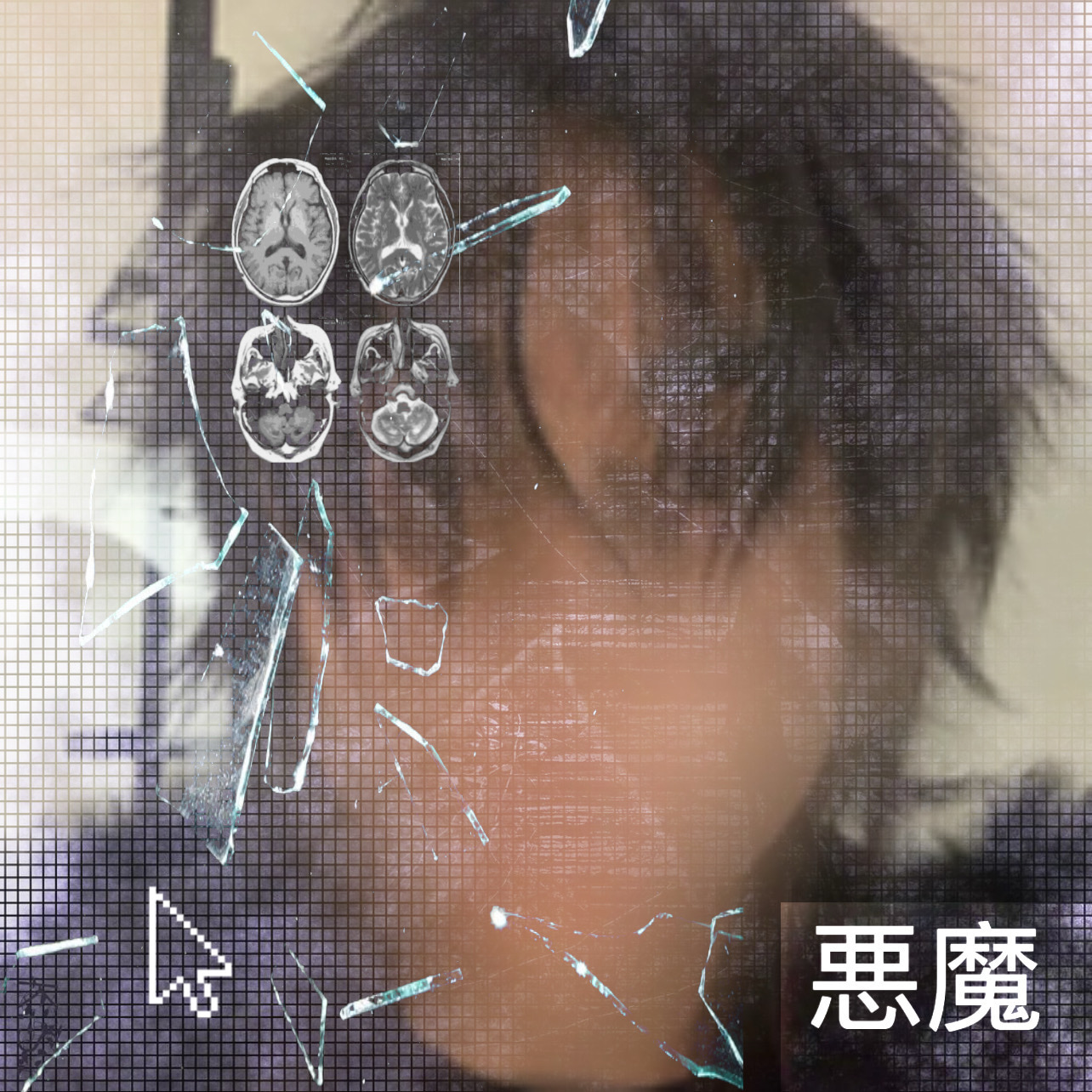 Brain scans are displayed on a screen with visible cracks and digital distortion.